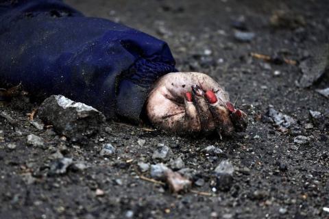 British Foreign Secretary Liz Trass reacted to the horrific photos of tortured Ukrainians